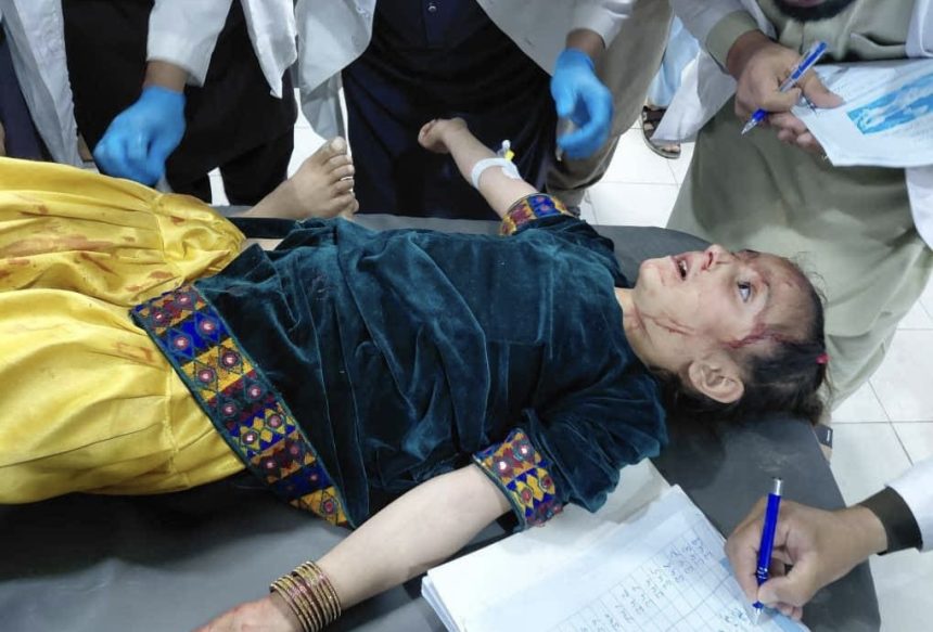 A young girl wounded in the Asadabad attack