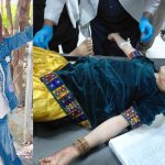 9-year-old Baharat, who was critically injured in Pakistani shelling in Asadabad, Kunar, and later died from her wounds.