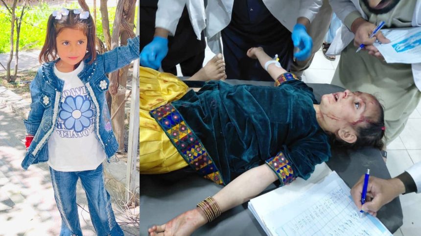Child killed in Kunar - The Afghan Times 9-year-old Baharat, who was critically injured in Pakistani shelling in Asadabad, Kunar, and later died from her wounds.